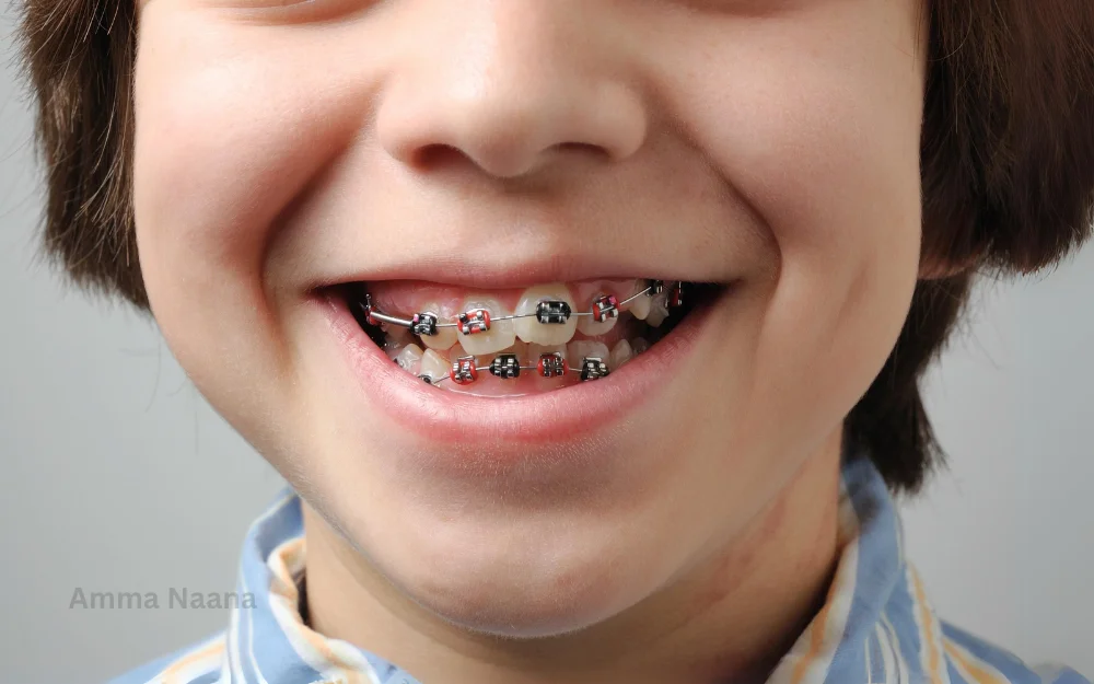 Braces for Children at Amma Naana