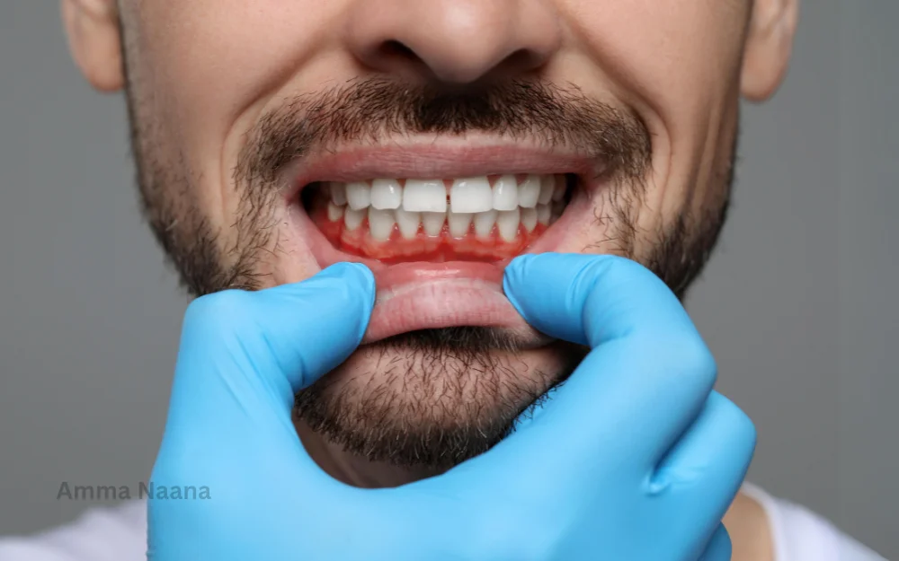 Gum Correction at Amma Naana Dental Clinic