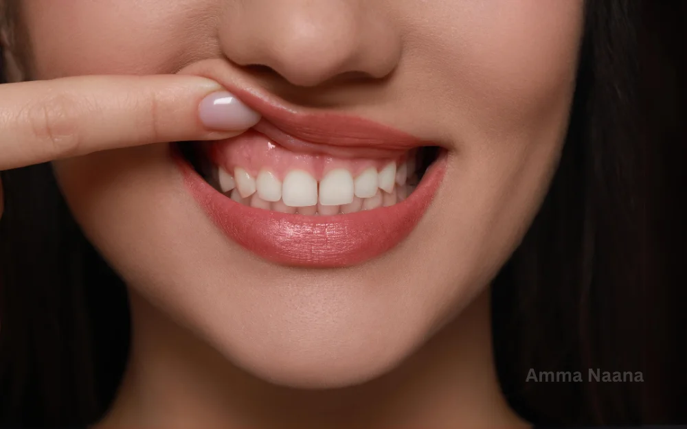 Gum Disease treatment at Amma Naana Dental Clinic