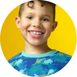 Invisalign for Kids Phase 1
